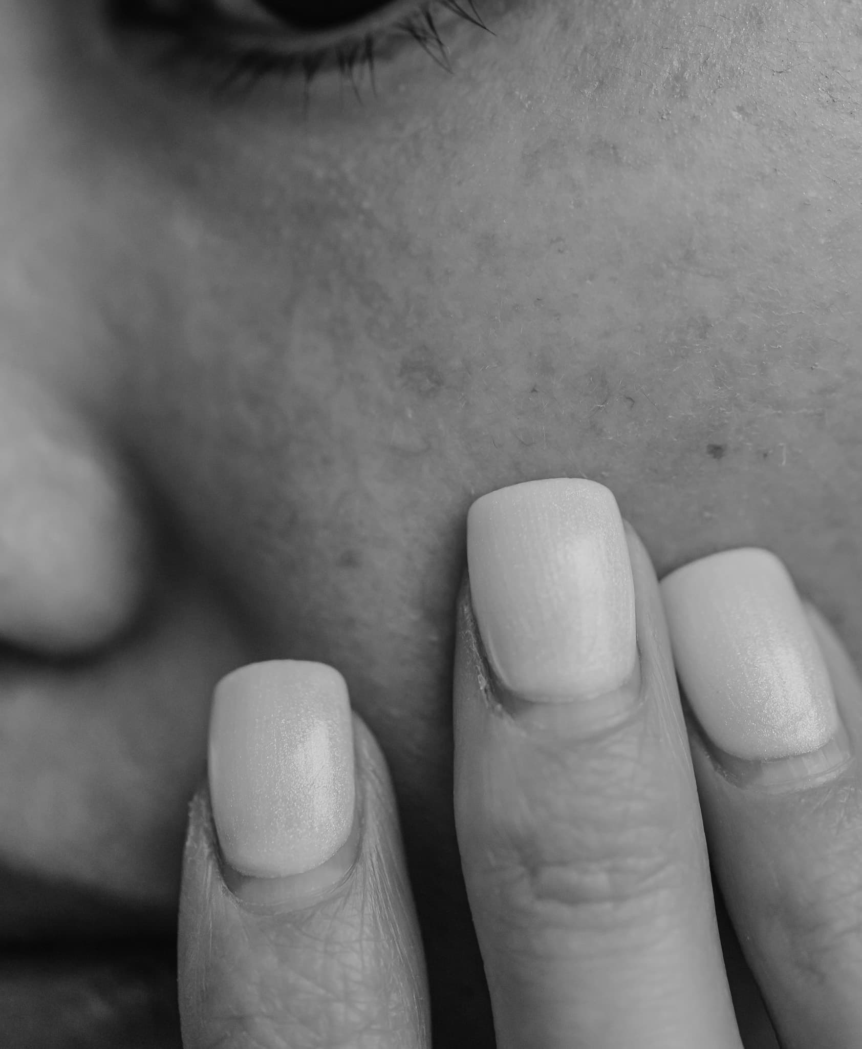 face cheek touch bw 2 — 512 Skincare